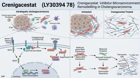 Crenigacestat (LY3039478) Crenigacestat inhibitor Microenvironment Remodeling in Cholangiocarcinoma