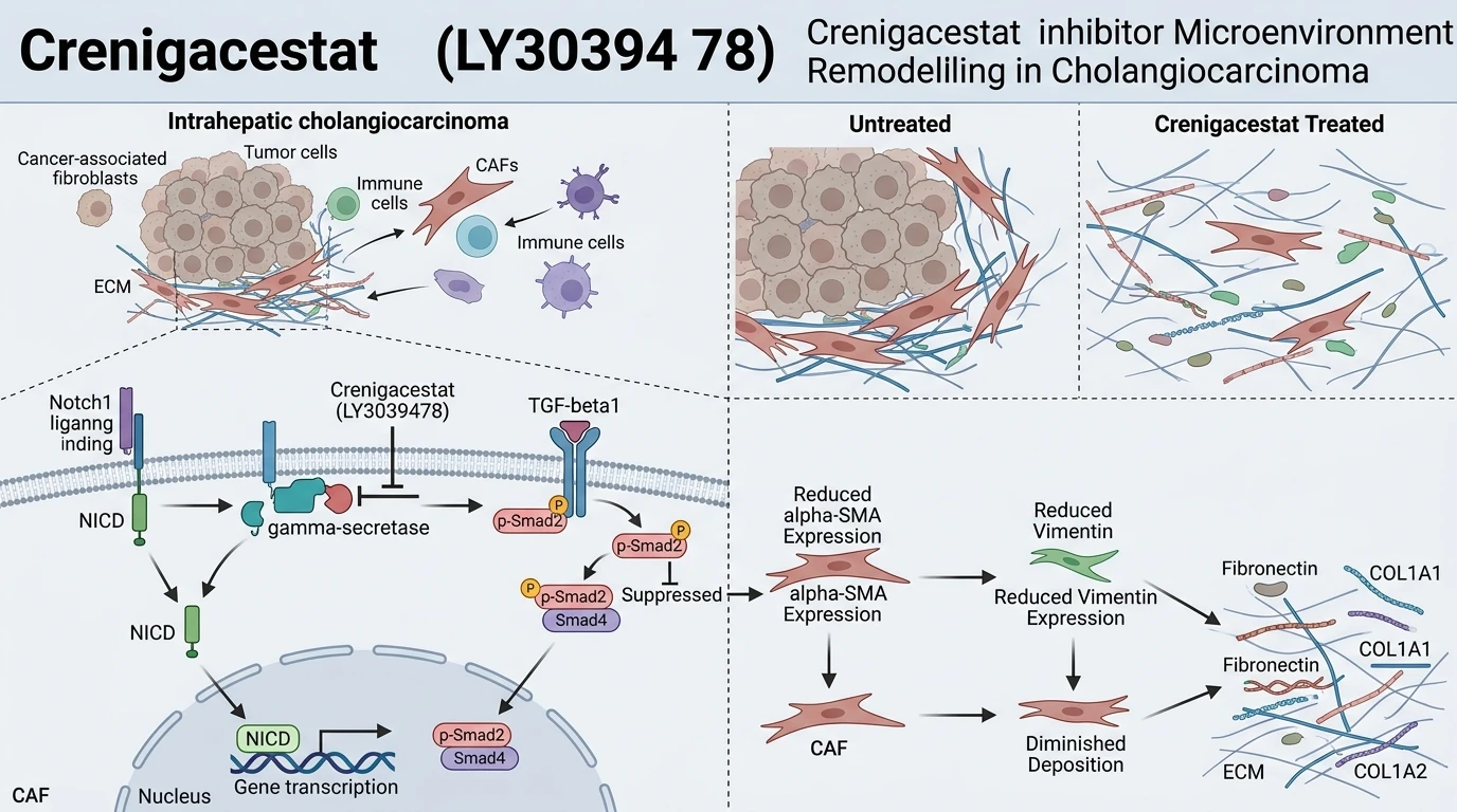 Schematic diagram of Notch1 gamma-secretase signaling pathway suppressing TGF-beta1 driven desmoplasia in cholangiocarcinoma